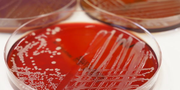 bacteria gram negativa